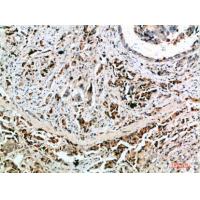 Nanos Homologue 1 (NANOS1) Polyclonal Antibody