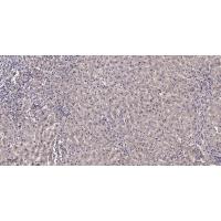 Nanos Homologue 1 (NANOS1) Polyclonal Antibody