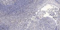 NARFL Polyclonal Antibody
