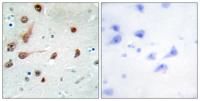 ADAR1 Polyclonal Antibody