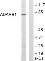 ADAR2 Polyclonal Antibody