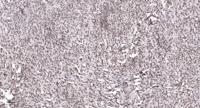 ADAR2 Polyclonal Antibody