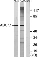 ADCK1 Polyclonal Antibody
