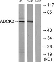 ADCK2 Polyclonal Antibody