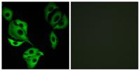 ADCK4 Polyclonal Antibody
