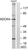 ADCK4 Polyclonal Antibody