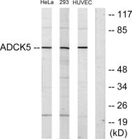 ADCK5 Polyclonal Antibody