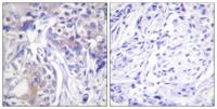 ADD1 Polyclonal Antibody