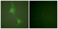 Adducin α/β Polyclonal Antibody