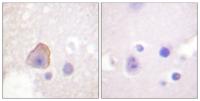 Adducin α/β Polyclonal Antibody