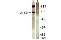 Adducin α/β Polyclonal Antibody