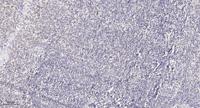 Adducin γ Polyclonal Antibody