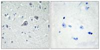 Adenosine A2A-R Polyclonal Antibody