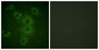 NBK Polyclonal Antibody