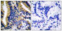 NBK Polyclonal Antibody