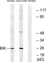 NBK Polyclonal Antibody