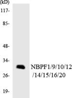 NBPF1/9/10/12/14/15/16/20 Polyclonal Antibody