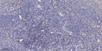 NBPF1/9/10/12/14/15/16/20 Polyclonal Antibody