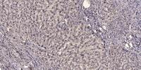 NCAM2 Polyclonal Antibody