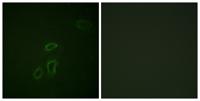 NCAM-L1 Polyclonal Antibody