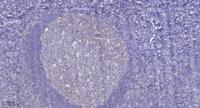 NCAM-L1 Polyclonal Antibody