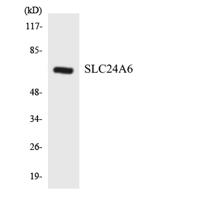 NCKX6 Polyclonal Antibody
