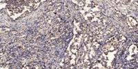 NCKX6 Polyclonal Antibody