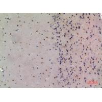 NCoA-3 Polyclonal Antibody