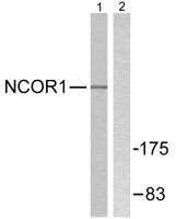 N-CoR Polyclonal Antibody