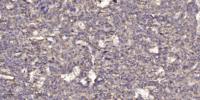 NCPR Polyclonal Antibody