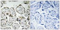ND1 Polyclonal Antibody