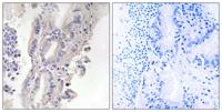 PLC-XD1 Polyclonal Antibody