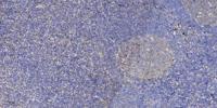PLEC Polyclonal Antibody