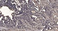 NDR2 Polyclonal Antibody