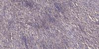NDRG2 Polyclonal Antibody