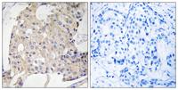 NDRG3 Polyclonal Antibody