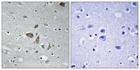 NDUFA4 Polyclonal Antibody