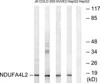 NDUFA4L2 Polyclonal Antibody