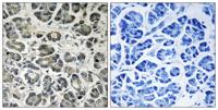 NDUFA8 Polyclonal Antibody