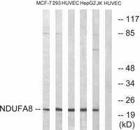 NDUFA8 Polyclonal Antibody