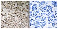 NDUFB1 Polyclonal Antibody