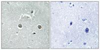 NDUFB10 Polyclonal Antibody
