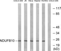 NDUFB10 Polyclonal Antibody