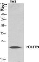 NDUFB9 Polyclonal Antibody