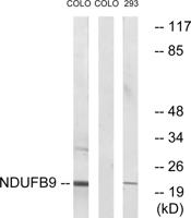 NDUFB9 Polyclonal Antibody
