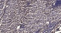 NDUFB9 Polyclonal Antibody