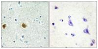NDUFC2 Polyclonal Antibody