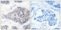 NDUFS1 Polyclonal Antibody