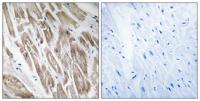 NDUFS5 Polyclonal Antibody