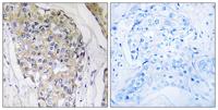 NDUFS6 Polyclonal Antibody